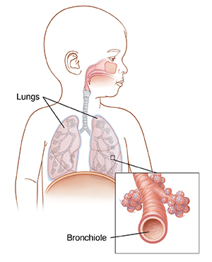 Front view of baby with head turned showing respiratory anatomy. Inset shows closeup of bronchiole and alveoli. 
