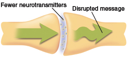 Neurotransmitters sending disrupted message from one neuron to the next.