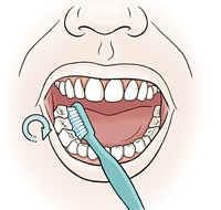 Closeup of mouth showing toothbrush brushing inside of lower molars.