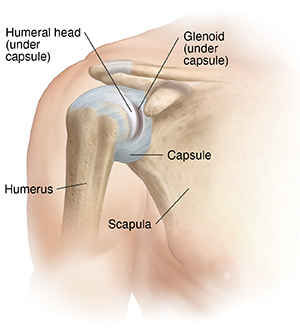 Front view of shoulder joint with muscles showing a contracted capsule and contracted ligament.