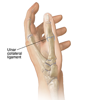 Side view of hand showing ulnar collateral ligament in thumb.