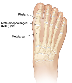 Top view of foot showing foot bones.