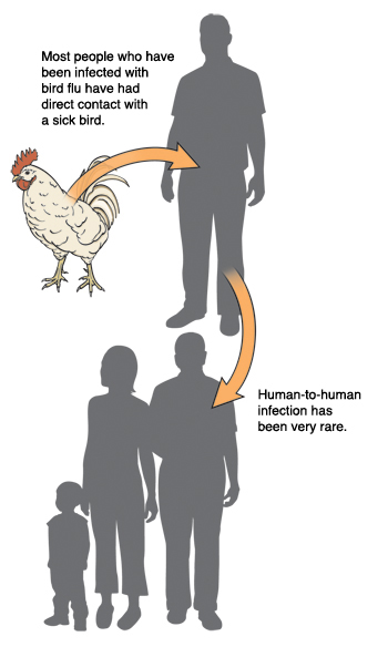 Pollo, hombre y grupo de personas. La mayoría de las personas que han sido infectadas con el virus de la gripe aviar han tenido contacto directo con un ave enferma. La infección entre seres humanos ha ocurrido en casos muy raros.