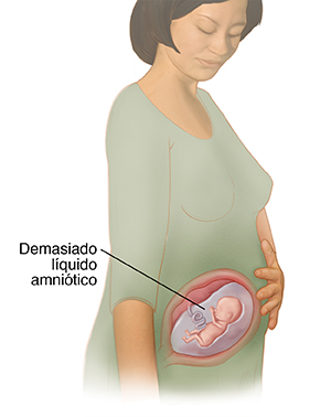 Vista de tres cuartos de una mujer embarazada en la que se muestra el feto en el útero con muy poco líquido amniótico.
