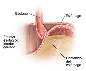 Primer plano de corte transversal de la parte superior del estómago, la parte inferior del esófago y el diafragma. Es esfínter esofágico inferior está cerrado, lo que mantiene el contenido del estómago dentro de este.