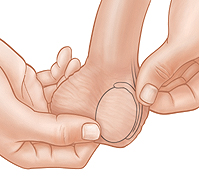 Primer plano de manos que revisan el epidídimo durante un autoexamen testicular.