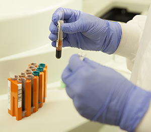 Técnica de laboratorio con equipo de laboratorio y muestras de sangre.