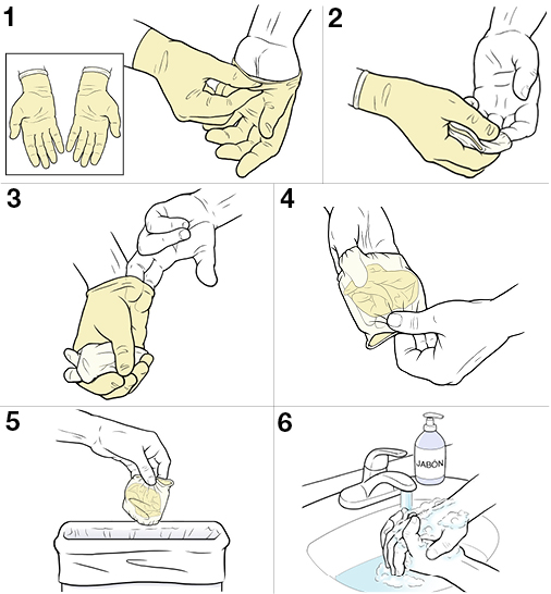 6 pasos para quitarse los guantes estériles.