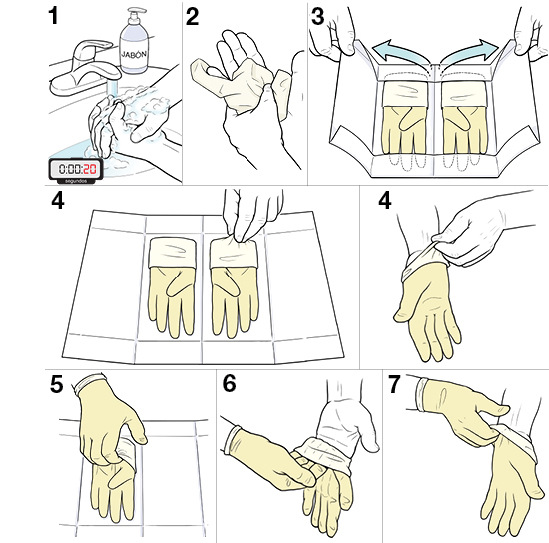8 pasos para ponerse los guantes estériles.