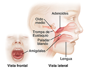 Vista frontal de la boca abierta de un niño donde se ven las amígdalas. Vista lateral de la cara de un niño donde pueden verse las amígdalas, las vegetaciones adenoides y el oído interno.