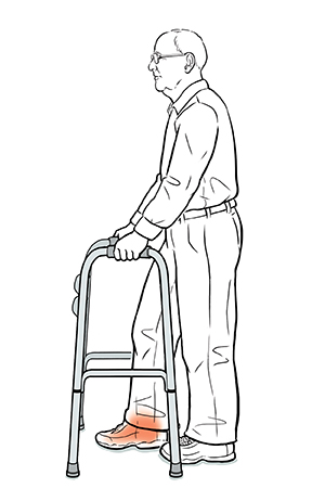 Hombre acomodándose en el andador con el pie lesionado, utilizando la técnica de soporte de peso.