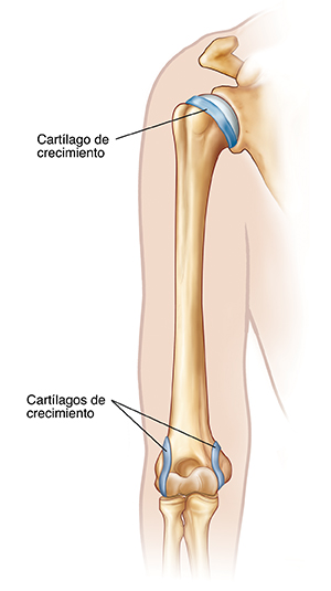Contorno de un brazo que muestra el hueso de la parte superior del brazo y las placas de crecimiento.