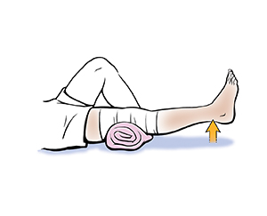 Pierna desde la rodilla hacia abajo que muestra las extensiones de rodilla de arco corto.