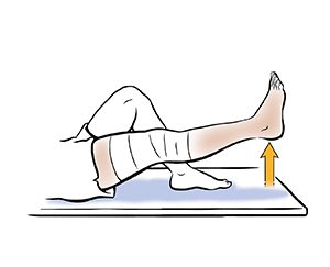 Pierna desde la rodilla hacia abajo que muestra la elevación de pierna extendida.