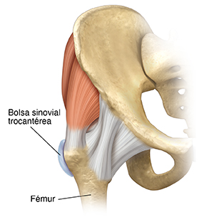 Vista frontal de la articulación de la cadera donde puede verse la bolsa sinovial trocantérea.