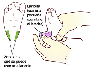 Vista inferior del pie de un bebé en la que se muestran las zonas para la punción en el talón. La zona verde indica la parte que se usa de la planta del pie. Manos con guantes sostienen una lanceta contra el talón del bebé.