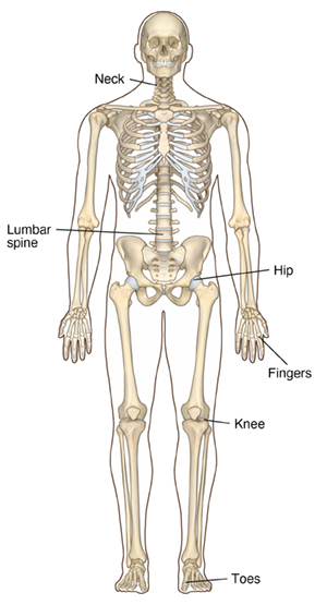 Front view of full skeleton in male outline showing joints often affected by osteoarthritis, including neck, lumbar spine, hips, fingers, knees, and toes.