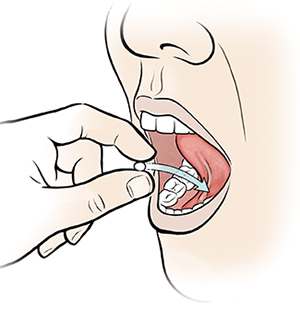 Primer plano de una boca. Se ven dedos que colocan una pastilla debajo de la lengua.