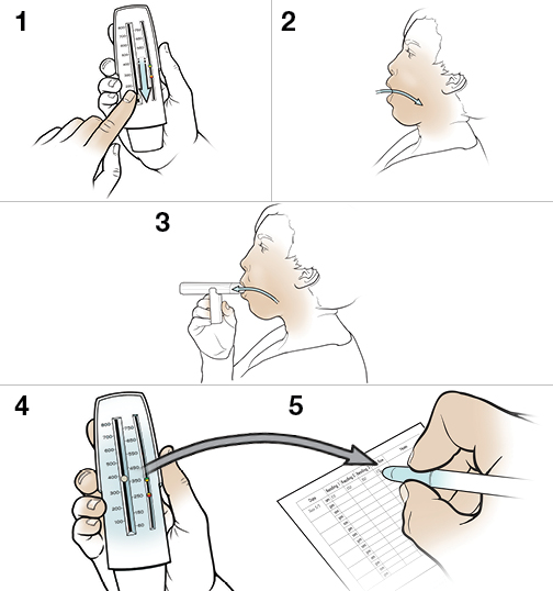 5 pasos para usar un medidor de flujo espiratorio máximo