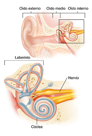 Corte transversal del oído que muestra el oído externo, medio e interno con un primer plano de una laberintitis.
