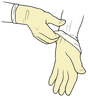 Mano enguantada que toma un guante estéril de un paquete de guantes estériles abierto empleando quatro dedos para tomar el guante por debajo del puño.