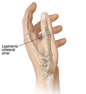Vista lateral de una mano donde se observa el ligamento colateral cubital en el pulgar.