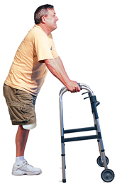 Hombre con amputación de una pierna, de pie lejos del andador, pero con las manos sobre las empuñaduras.