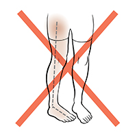 Vista frontal de piernas en las que un pie y una pierna están rotados hacia el centro. La X roja indica que esto no debe hacerse.