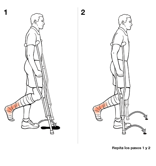 Dos pasos para realizar la técnica semipendular con muletas (sin soporte de peso).
