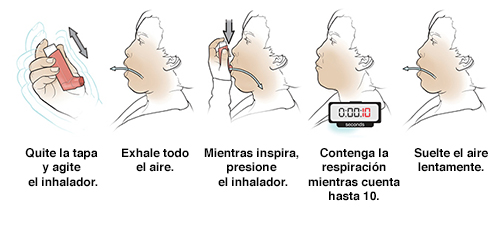 Cinco pasos para usar un inhalador con dosis medida sin espaciador.