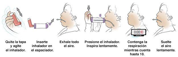 Seis pasos para usar un inhalador con dosis medida con espaciador.