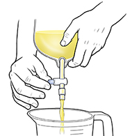 Primer plano de manos que abren una válvula en una bolsa de catéter urinario para drenar la orina en una taza medidora.