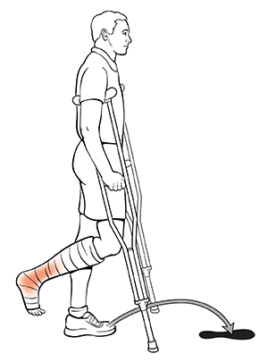 Vista lateral de un hombre usando muletas. La flecha indica dónde colocar el pie para la técnica pendular.