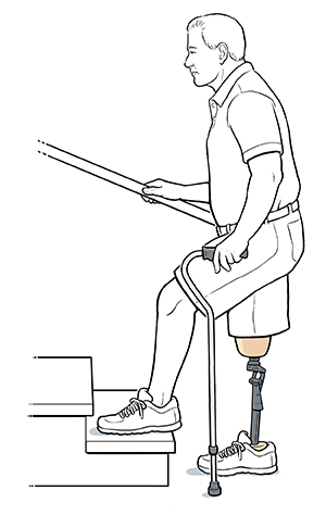 Hombre con pierna ortopédica que sube una escalera con bastón.