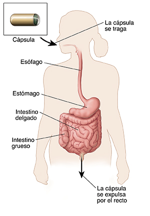Contorno de un cuerpo en el que puede verse el tracto gastrointestinal y el recorrido que hace la cápsula utilizada para una endoscopia por cápsula.