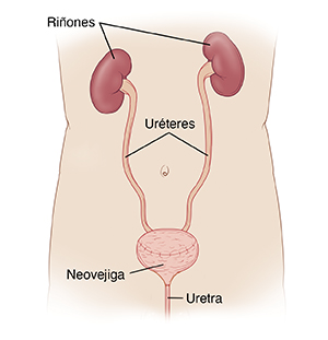 Vista delantera de un torso masculino, donde pueden verse los riñones conectados a la vejiga nueva mediante los uréteres. La vejiga nueva se conecta a la uretra.