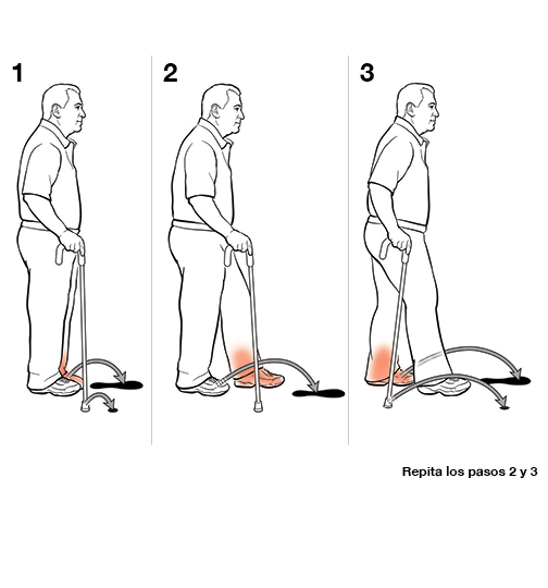 Tres pasos para usar un bastón.