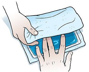 Primer plano de manos que envuelven una compresa de hielo en una toalla.