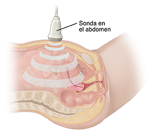 Corte transversal de una pelvis femenina vista de lado. Hay un transductor de ultrasonido sobre el abdomen inferior.