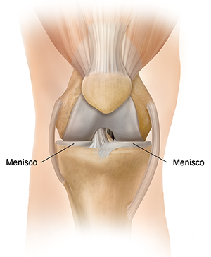 Vista frontal de una rodilla donde se observa el menisco medial y el menisco lateral.
