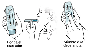Tres pasos en que una niña usa un medidor de flujo espiratorio máximo.
