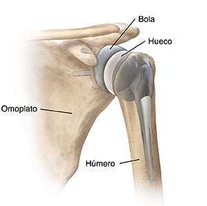 Vista frontal de la articulación del hombro con una prótesis total de hombro invertida.
